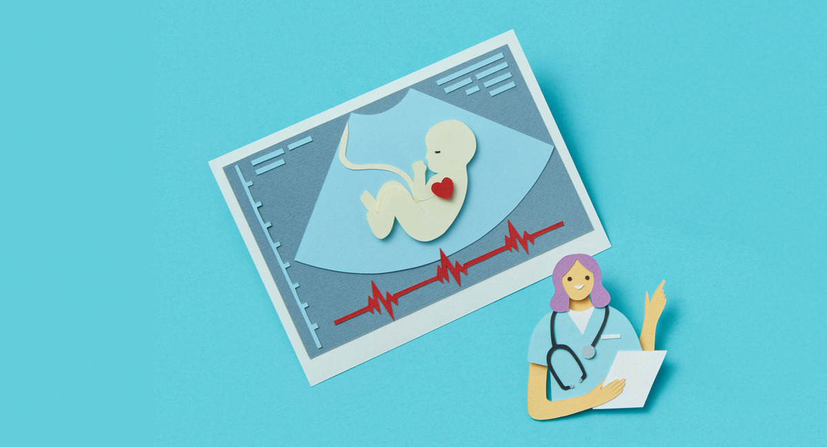 Paper-cut illustration of a prenatal anatomy scan showing a fetus ultrasound with heartbeat line beside a clinician holding a chart on a turquoise background.