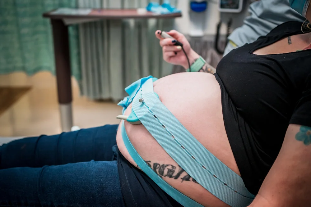 Pregnant person reclining with monitoring belts and sensors across their belly in a clinical room.
